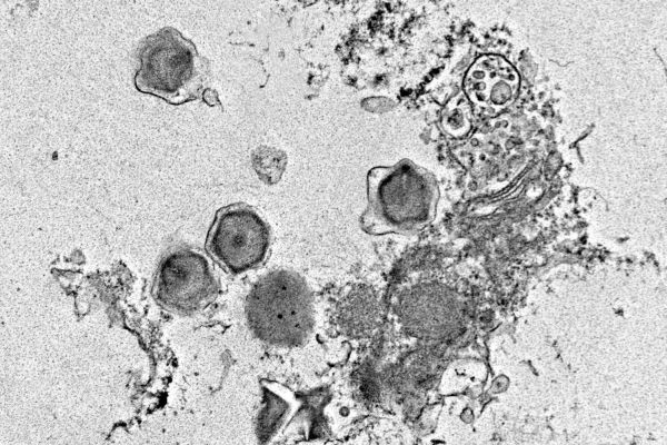 Ученые открыли сотни новых гигантских вирусов, влияющих на океанические экосистемы