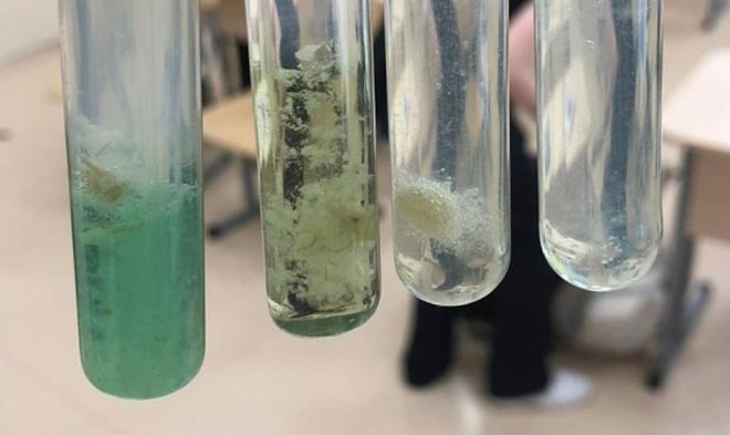 В Новосибирске разработали тесты для оперативного выявления коклюша