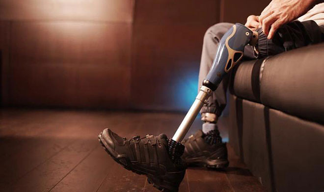 В России впервые провели имплантацию модульного эндопротеза