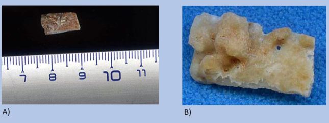 Загадочному черепу из греческой пещеры оказалось не менее 286 000 лет