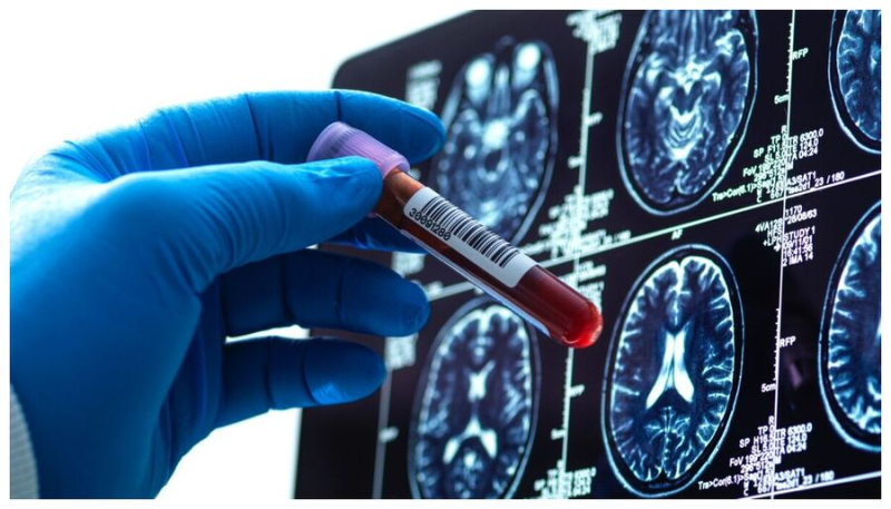 Суперредкая &laquo;гибридная&raquo; группа крови обнаружена всего у трёх человек