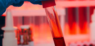 Углекислый газ в нашей крови: ученые обнаружили пугающую параллель между атмосферой Земли и химией человеческого тела