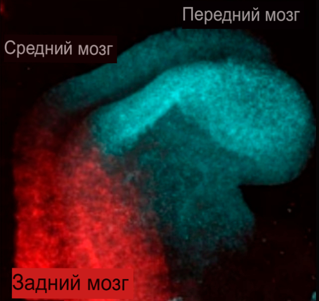 Мозг — это не один орган, а два: открытие, которое переписывает учебники